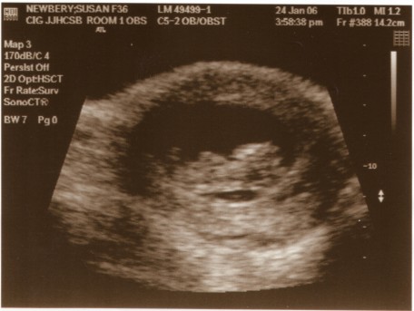 whoa, that's our baby in there!